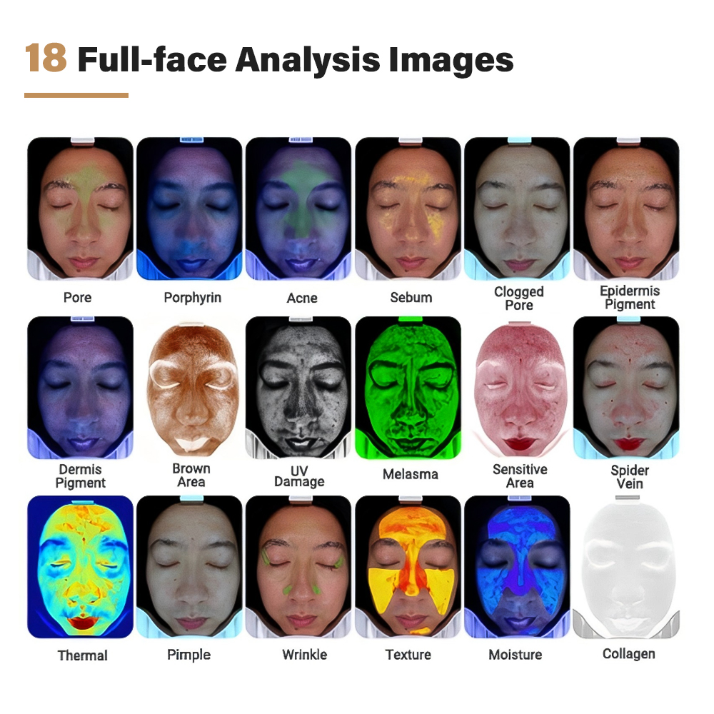 F3-06 Skin analysia facial skin analyzer machine (6)
